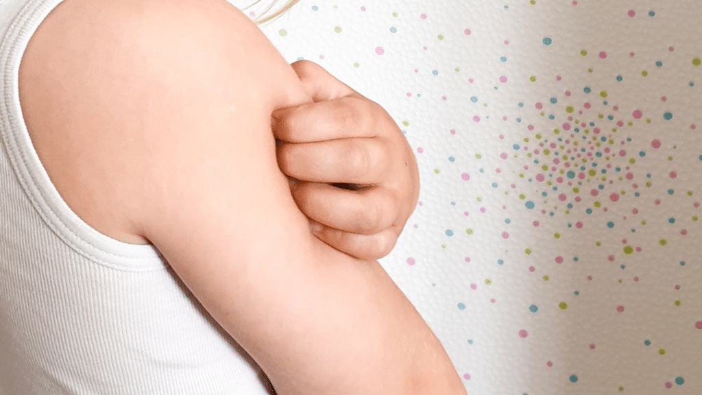 Empfindliche Haut bei Kindern